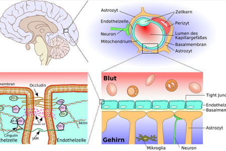 blog-leaky-brain