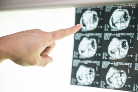 blog-what-is-neurofeedback
